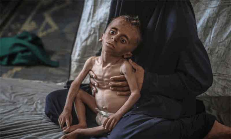 Hunger and famine and the Gaza Genocide